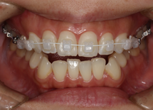 ホワイトワイヤー