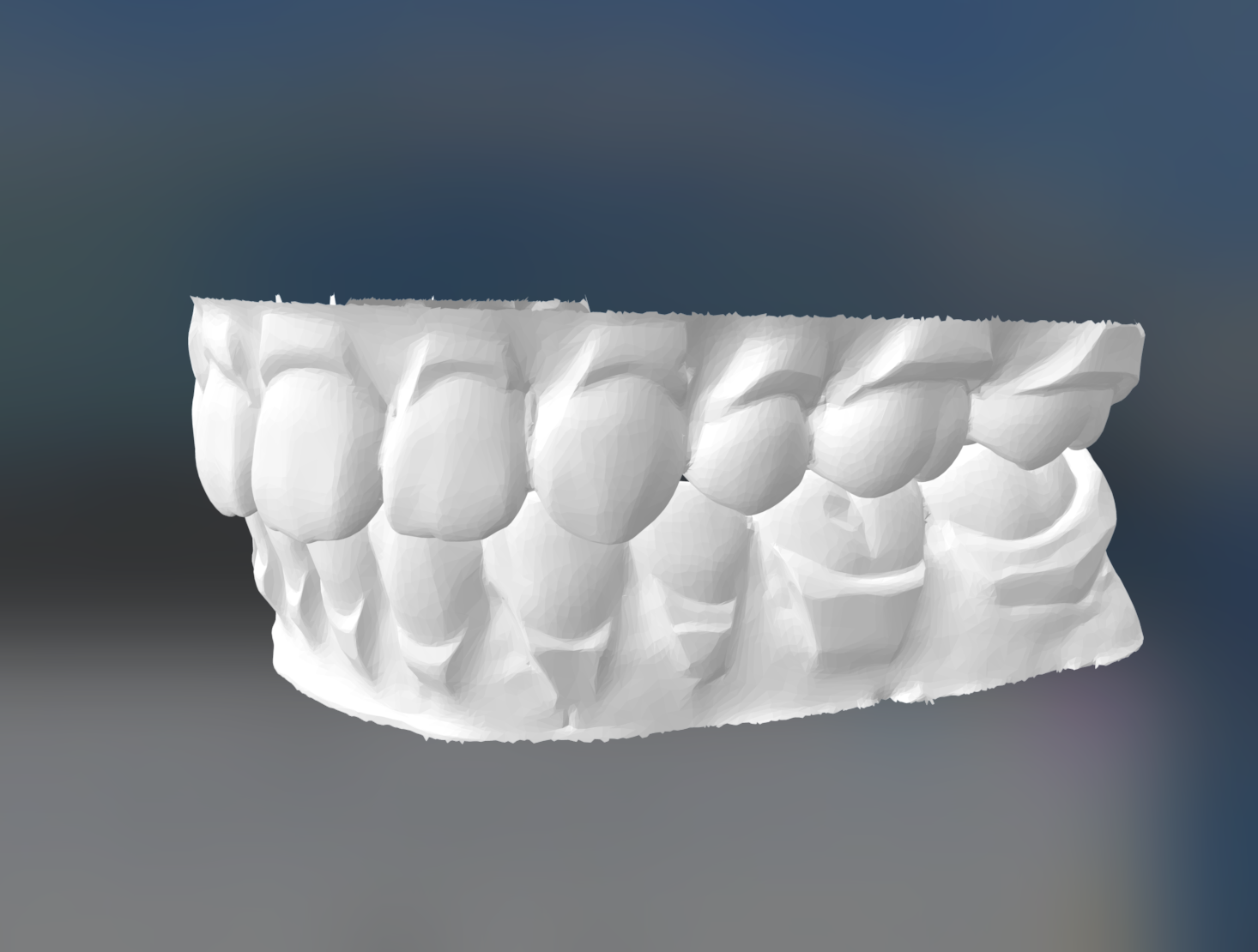デジタルセットアップ