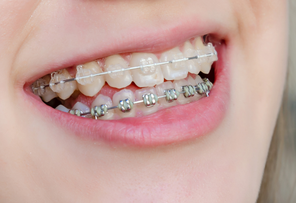 img - 2025-11-19T155338.968