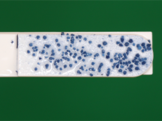 ミュータンス菌