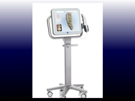 口腔内デジタルスキャナー